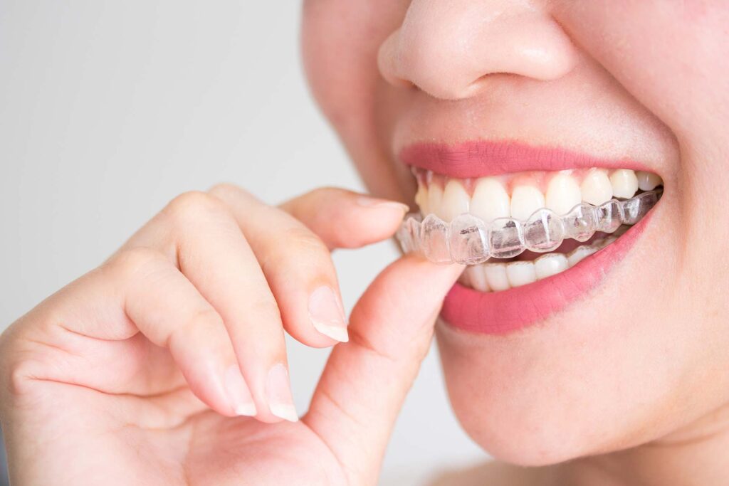 orthodontic-dental-care | Best Dentists In Toronto